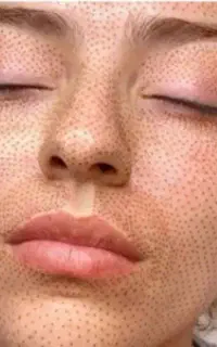 خدمات حرفه ای پلاسماجت