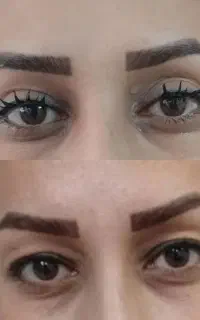 جوانی رو ب پوستت هدیه بده