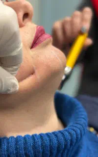 بوتاکس ژل مزو پی آر پی