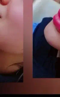 ٪۳۰آف آموزش وخدمات ژل بوتاکس آنزیم ومزوصورت