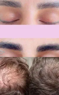 اکسیر رویش مجدد و تقویت مو  نسخه طب سنتی