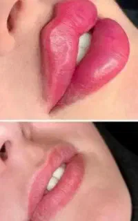 فیلربادی ۱۰۰ سی سی ۱۰ تومن . ژل صورت از ۶۰۰