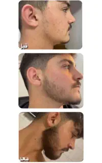 ریش و سبیل در کمترین زمان
