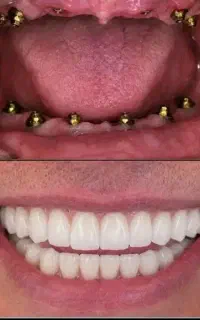 مرکز تخصصی دندان پزشکی و ایمپلنت مختص افراد حساس
