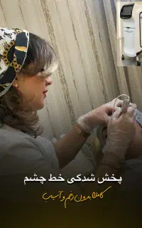 پاک کردن تاتوصورت و بدن