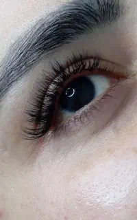 کاشت مژه