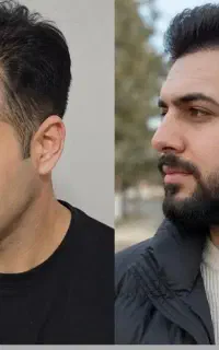 کاشت ممنوع شد