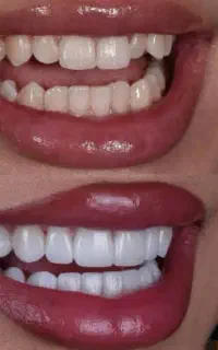دندانپزشکی و دندانسازی(ویزیت رایگان)