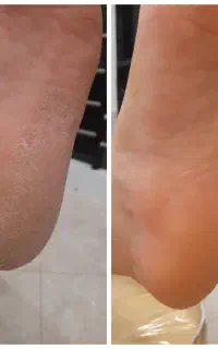پاکسازی صورت