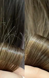 موخوره تراپی همراه اکسیژن تراپی رایگان در سه مرحله
