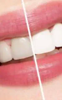 لمینت زیبا تضمینی