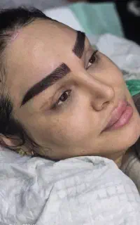 کاشت ابرو فقط ۲۲میلیون (شرایطی)