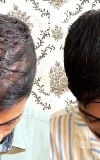 با مشکلات مو خداحافظی کن