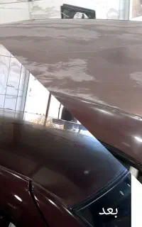 رفع آفتاب سوختگی