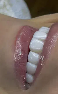 جذب  دستیار دندانپزشکی