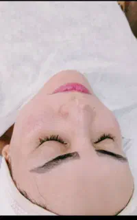 تخفیف ویژه فیشیال درمانگاه فرهنگیان