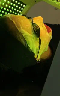 فشیال پوست صورت