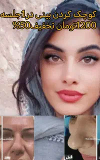 (کوچک کردن بینی فقط با1جلسه1200تومان) 50%تخفیف