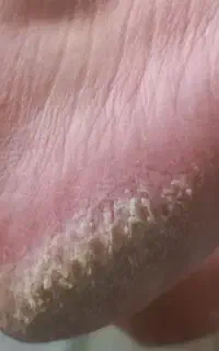 تخفیف ویژه کاشت مژه وفیشیال واسپا