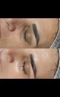 فیشیال وپاکسازی تخصصی پوست
