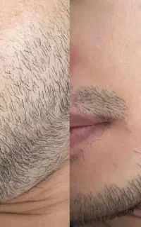 این اخرین روشیه که امتحان میکنی