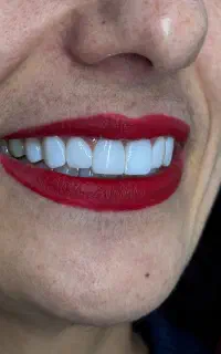 کامپوزیت با شرایط اقساط