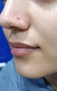 پیرسینگ ومیکرودرمال