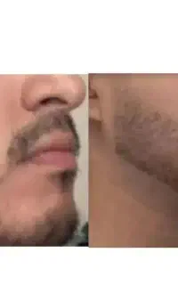 ریش و سبیل
