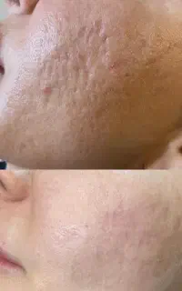 نیازمندمدل خانم و آقا با ترک های پوستی زیاد