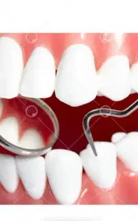 ایمپلنت لمینت کامپوزیت عصبکشی دندانپزشکی کلینیک دی