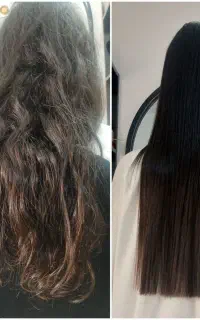 انجام موخوره گیری در منزل یا سالن
