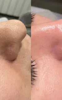پاکسازی صورت و پدیکور پا ۴۸۰