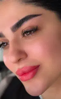 زیبایی نیلگون تخفیف میکروبلیدینگ،فیبروز،فیلر(ژل)