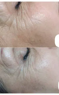 فیشیال ـ پاکسازی ـ پوست.