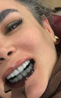 کامپوزیت دندان عصب کشی جراحی ایمپلنت کاشت روکش