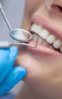 آفر ویژه سفید کردن دندان در دندانپزشکی(اقساط ویژه)