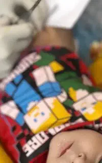 ختنه با فوتونا بدون خونریزی