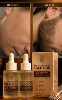 احیاسازی فولیکول برای تو