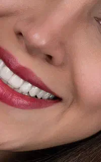 دندانپزشکی تخصصی،کاشت ایمپلنت با ضمانت+اقساط ویژه