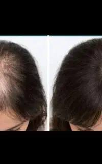 موهای پرپشت، حس بهتر