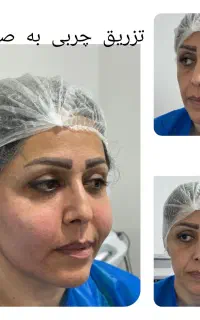 جراحی زیبایی و بلفاروپلاستی