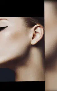 جراحی های زیبایی بدن و صورت، ساکشن و تزریق