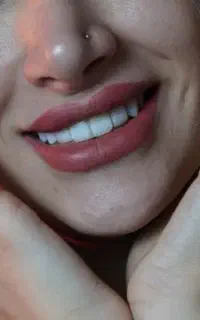 جشنواره بهاره دندانپزشکی با اقساط و تخفیف ۴۰ درصد