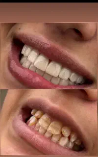 خدمات دندانپزشکی با بهترین متریال مصرفی