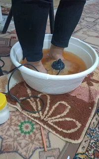 سم زدایی کل بدن با دستگاه