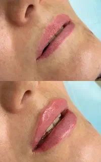 کلینیک زیبایی و مرکز لیزر دژآباد در رودسر