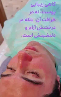 پاکسازی و فیشال صورت آقایان درلارستان