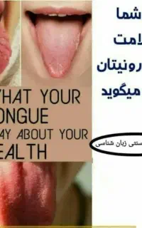 سونوگرافی کامل بدن از روی عکس زبان