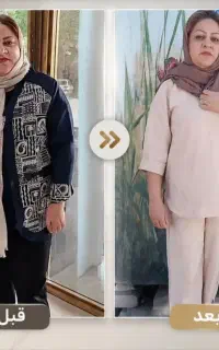 لاغری بدون ورزش و رژیم سخت