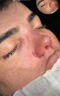 جراحی بینی فقط 50 اهواز انجام میشه